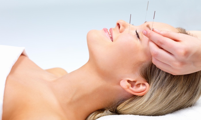 Benefits of Acupuncture Over Western Medicine
